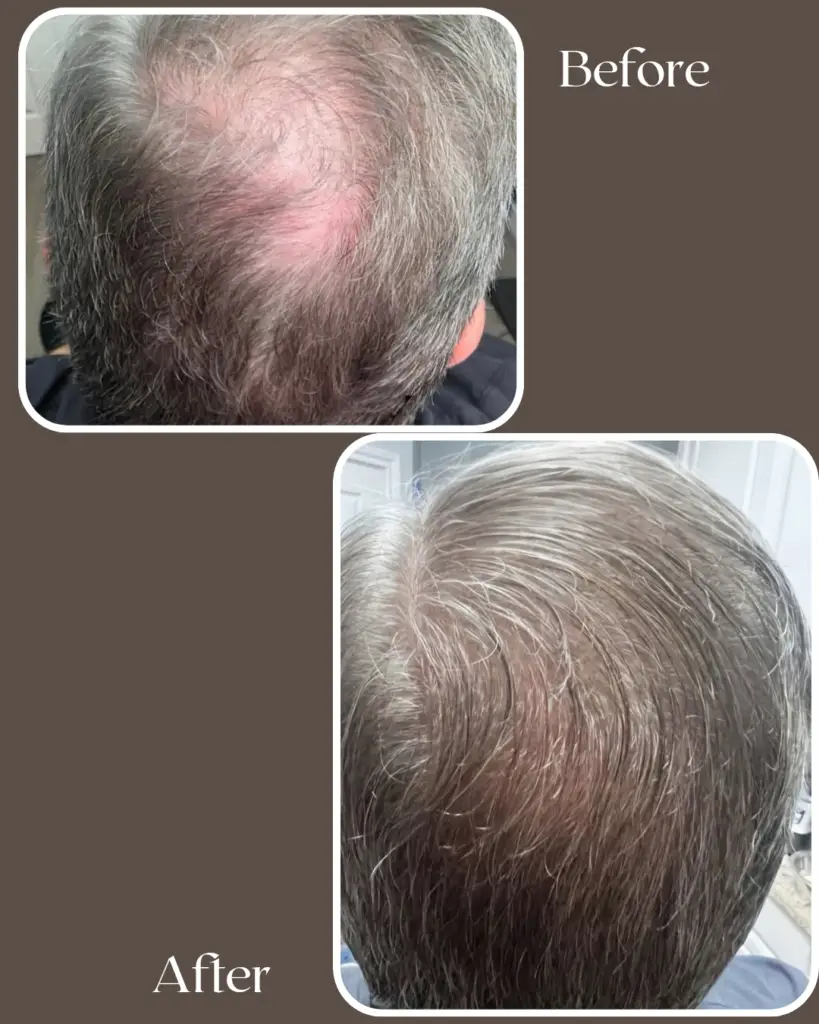 after 20260111 135454 0000