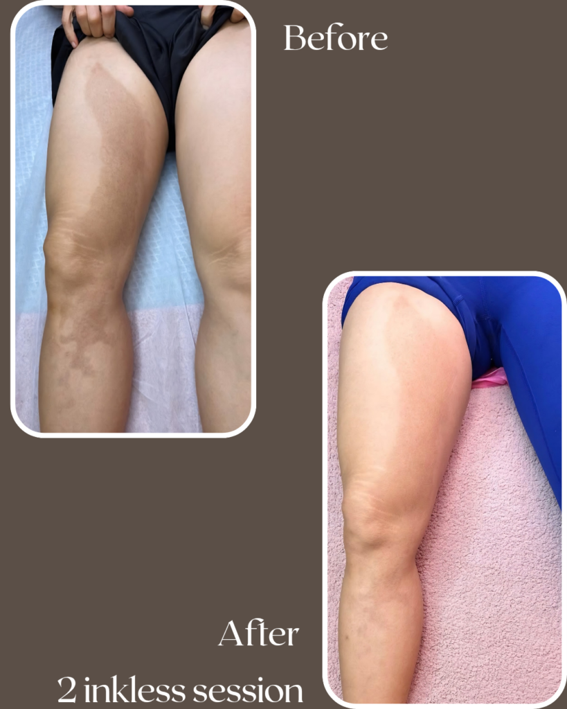 after 20260111 141120 0000