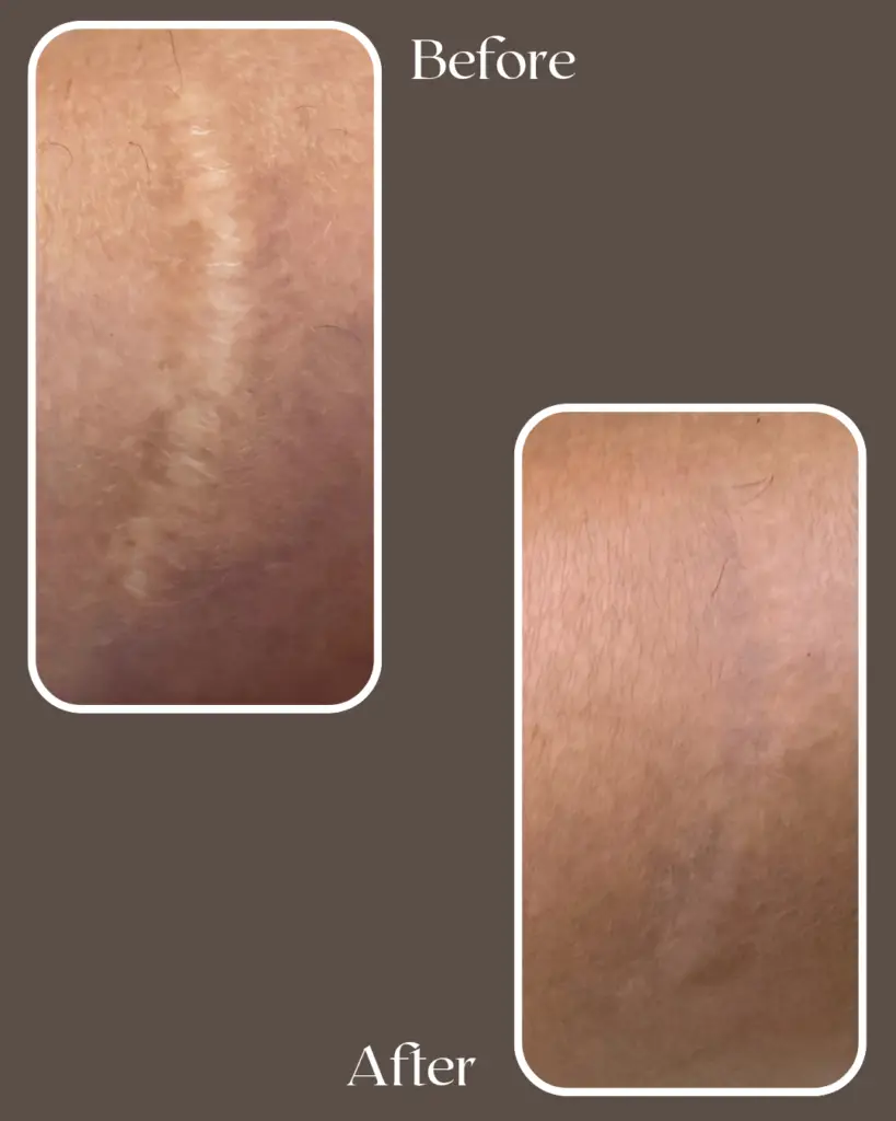 after 20260111 142348 0000