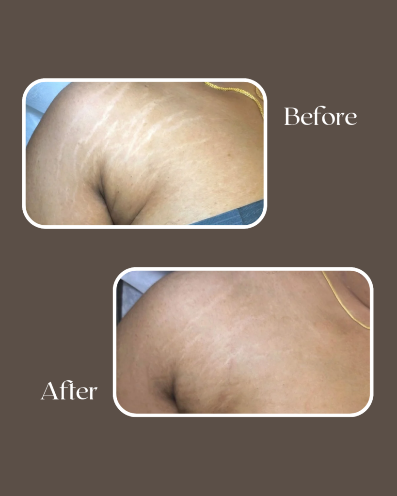 after 20260111 143333 0000