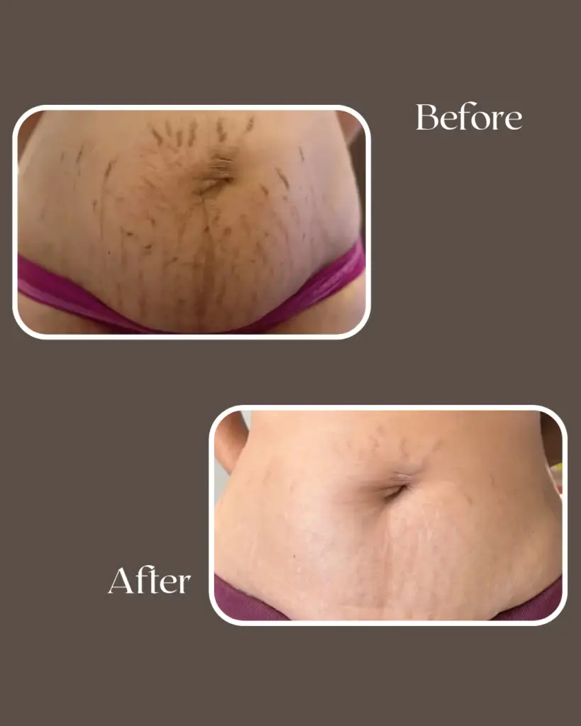 after 20260111 143430 0000