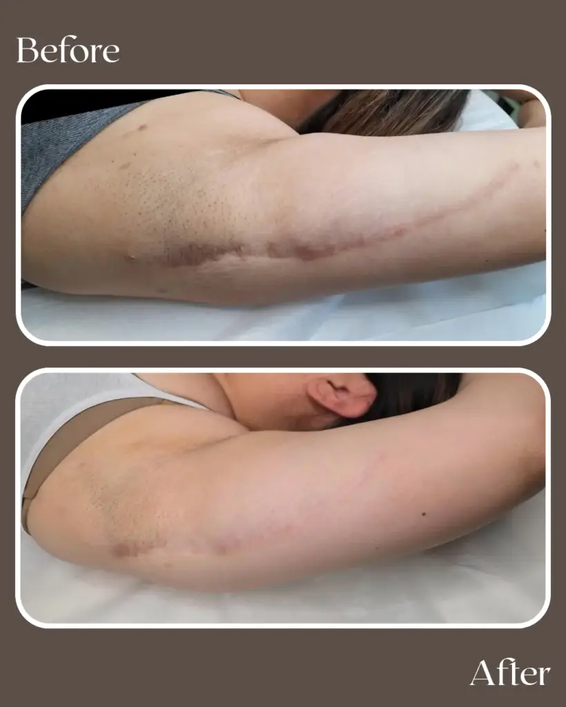 before 20260111 133511 0000