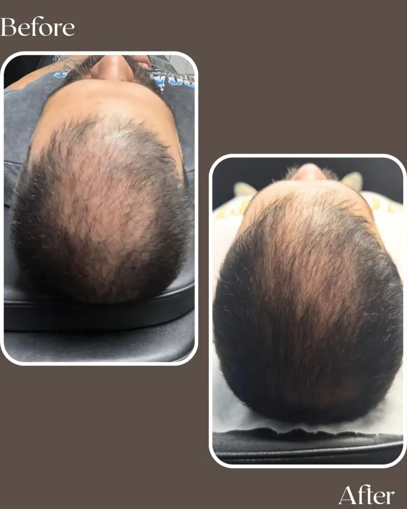 before 20260111 133545 0000