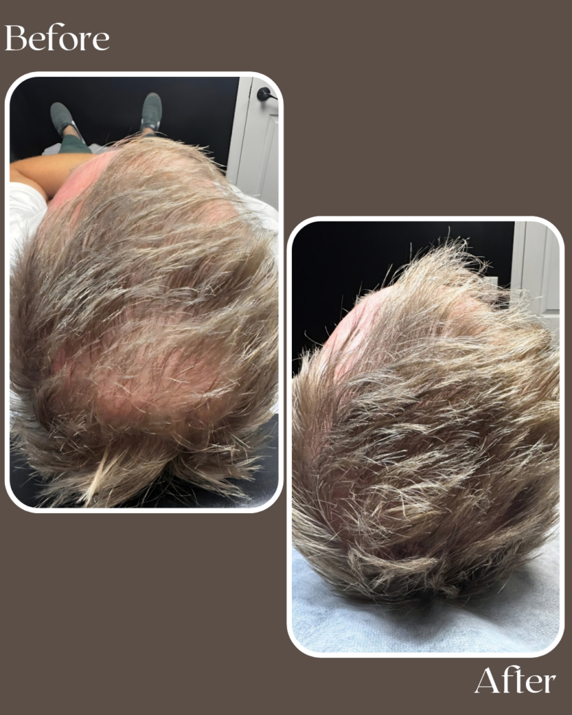 before 20260111 134029 0000