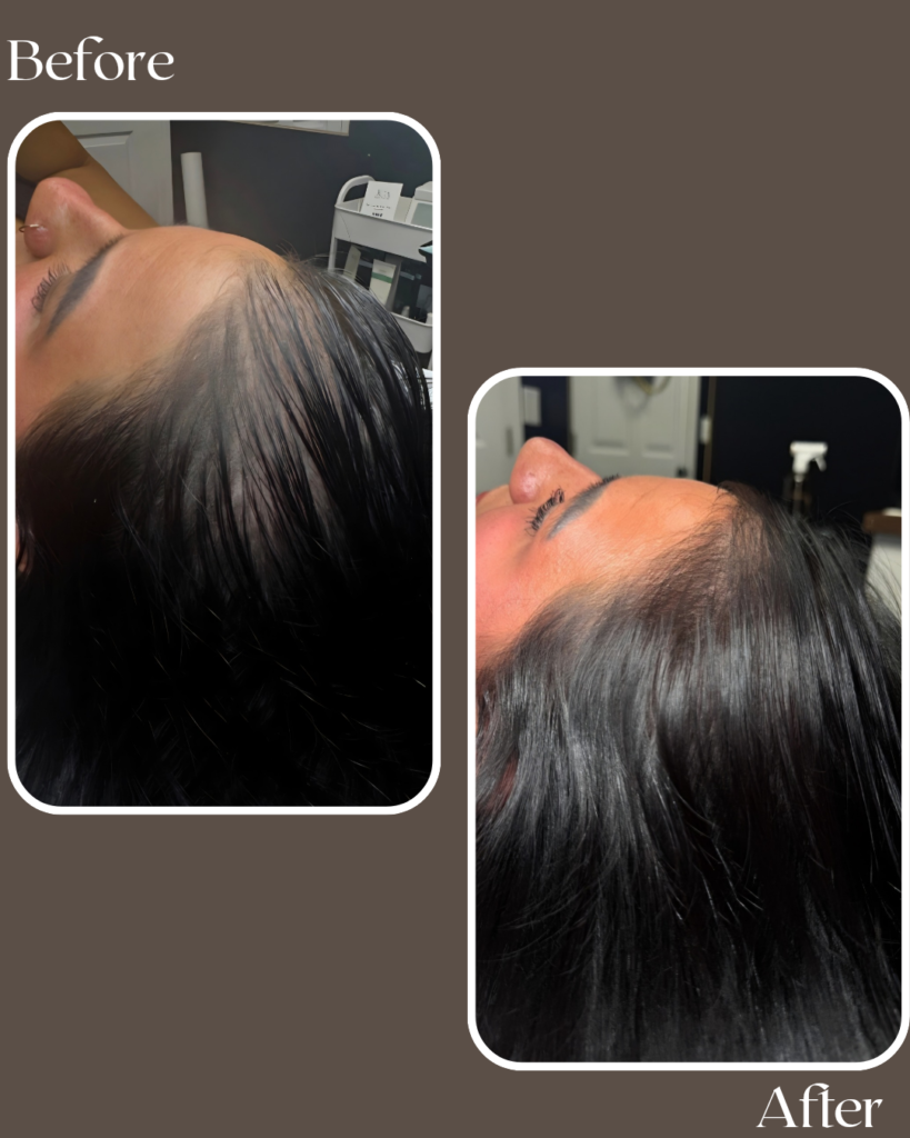 before 20260111 134330 0000